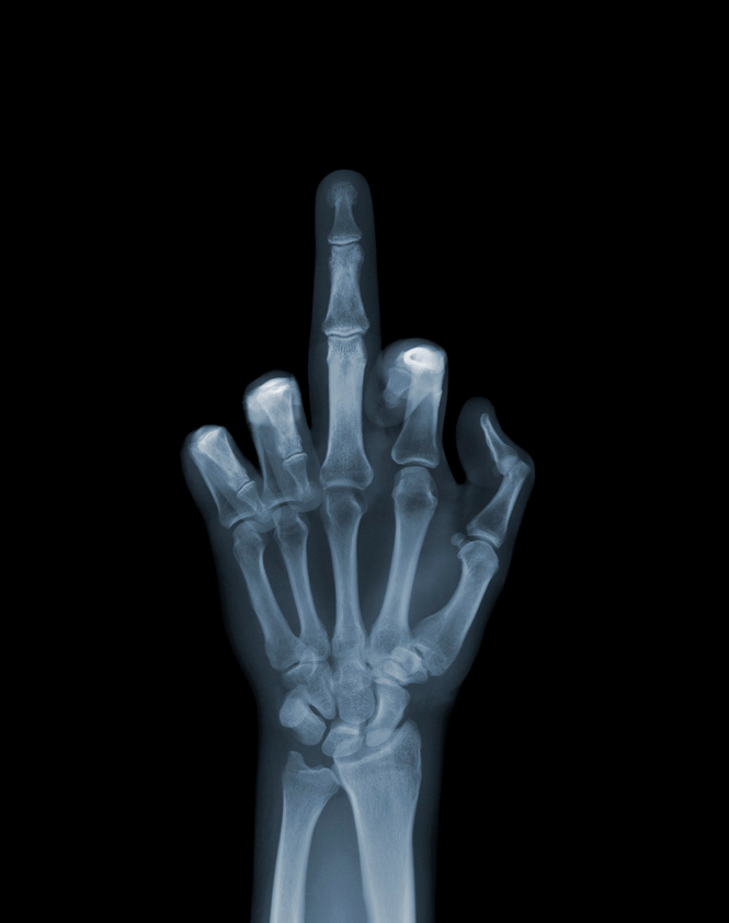 X-Ray Photography by Nick Veasey feeldesain 01